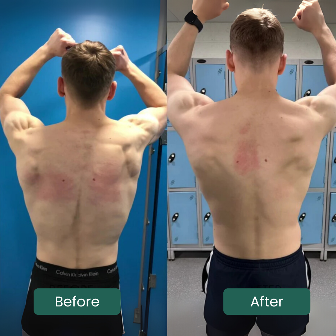 Posture corrector | Maintain good posture with the right support