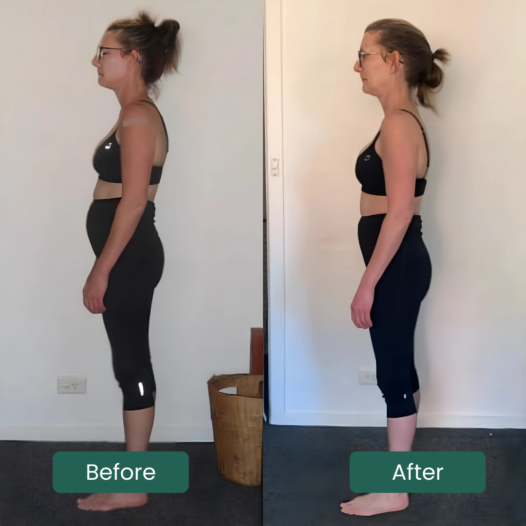 Posture corrector | Maintain good posture with the right support